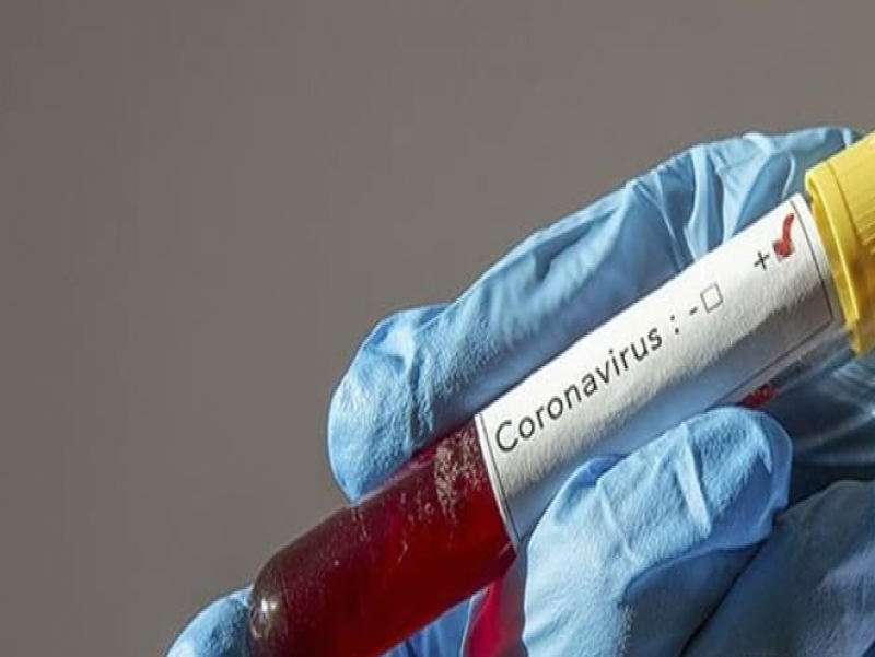 Ковид-19 вирусаар 5.6 сая хүн өвчиллөө